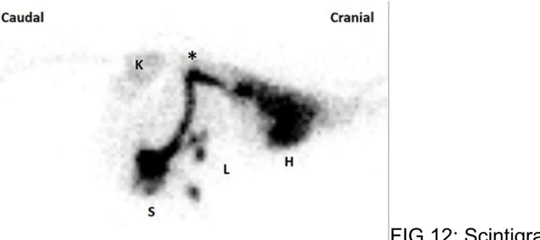 FIG 11: Scintigrafia 