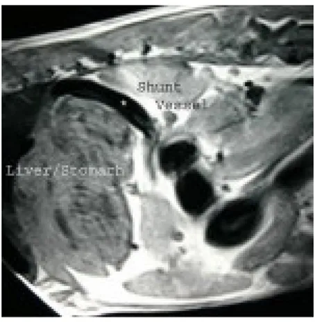 FIG 15: Immagine sagittale di uno shunt che passa   dorsalmente allo  stomaco e si inserisce nella vena porta cranialmente al diaframma