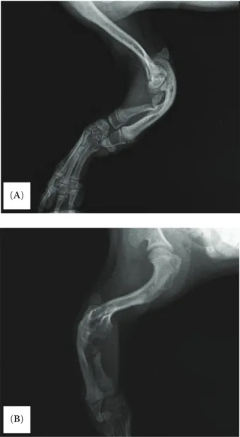 Figure 1. Dorsal (A) and ventral (B) views. Deficient  right forelimb characterized by the complete ankylosis  of the elbow and short leg