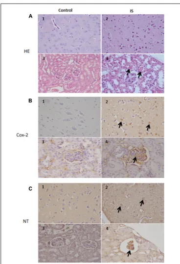FIGURE 7 | Histologic and immunohistochemical findings of brain and kidneys in treated mice (IS column)