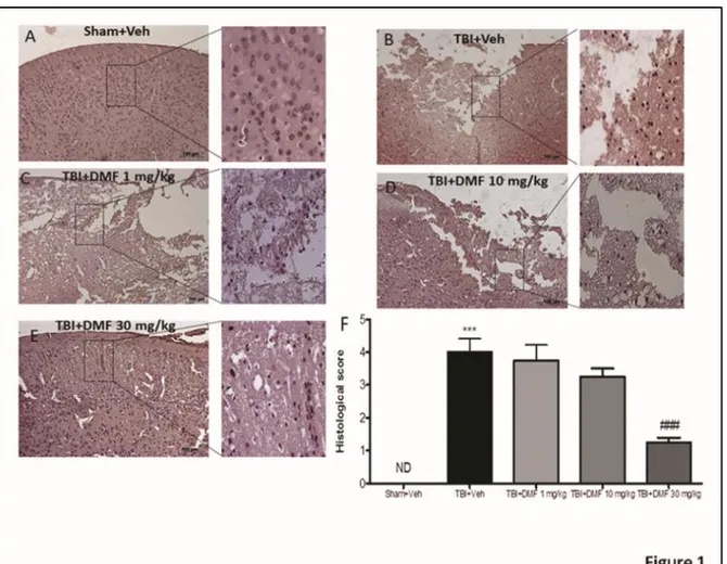 Figure 3.1: Effects of DMF treatment on histological alterations after TBI 