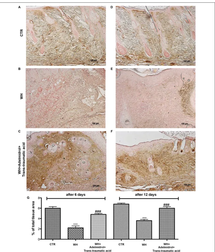 FIGURE 7 | Effects of adelmidrol + trans-traumatic acid on levels of TGF- β in skin after 6 and 12 days from wound