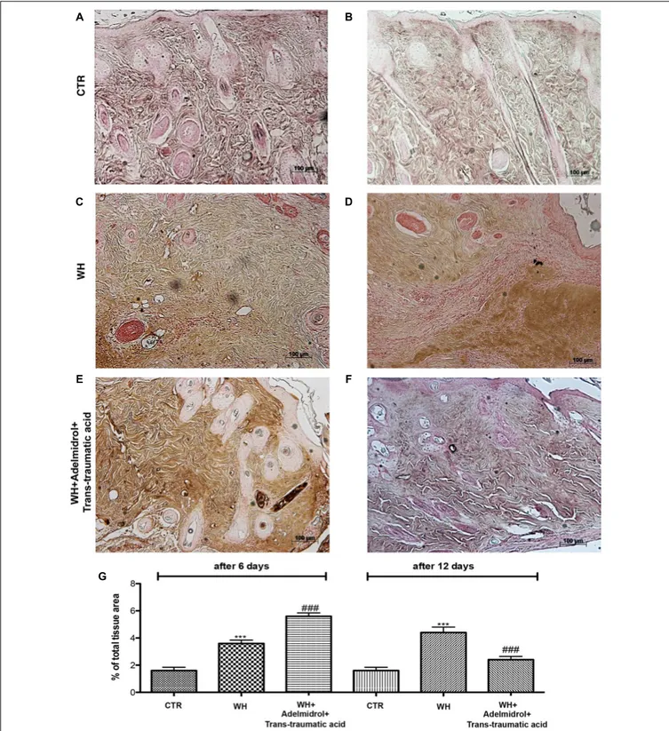 FIGURE 9 | Effects of adelmidrol + trans-traumatic acid on levels of VEGF in diabetic mice after 6 and 12 days from wound induction