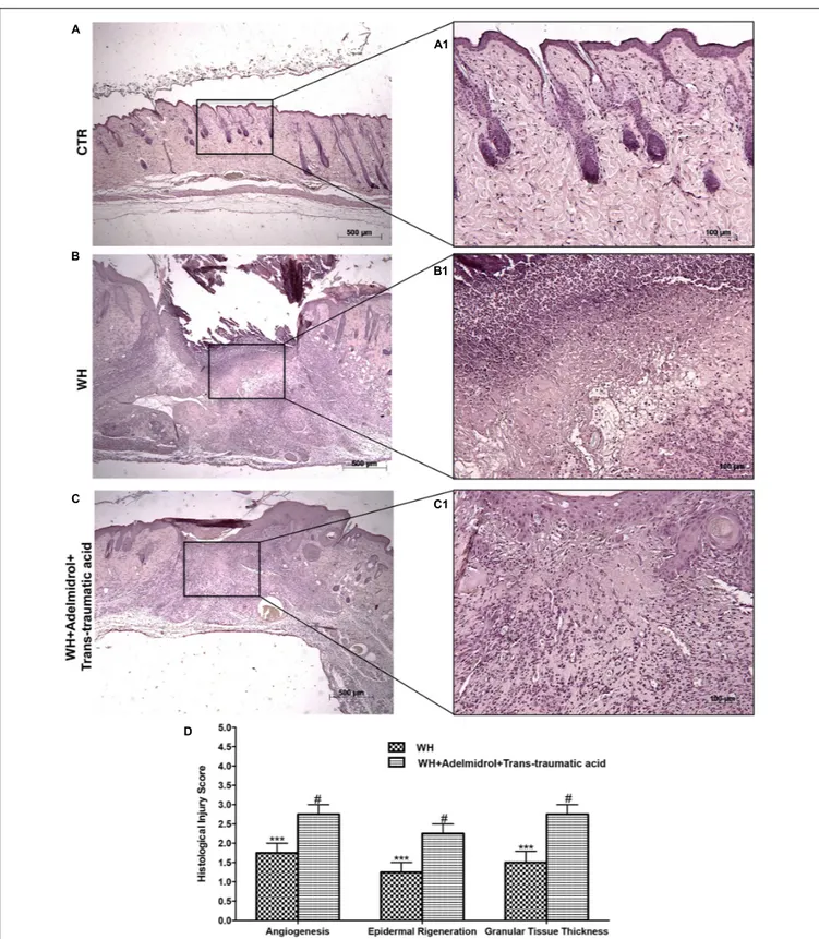 FIGURE 1 | Effects of adelmidrol + trans-traumatic acid on histological parameters after 6 days from wound induction