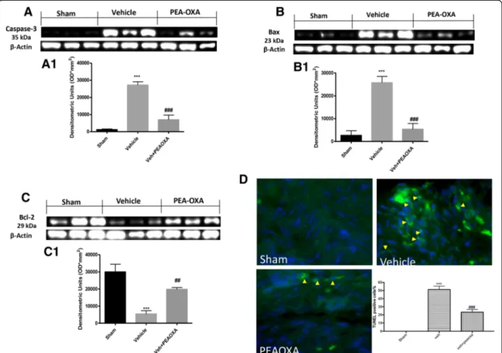 Fig. 5 Effect of PEA-OXA on apoptotic pathway after sciatic nerve crush. Western blot analysis of the lumbar portion of the spinal cord showed the expression and relative densitometric analysis for caspase-3 (a, a1); Bax (b, b1); Bcl-2 (c, c1)