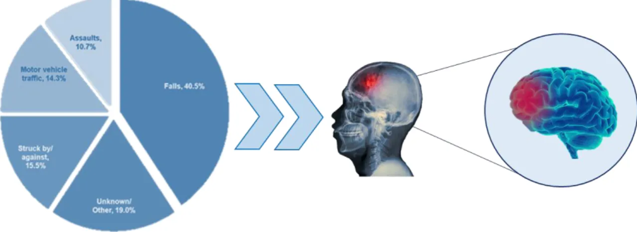 Figure 7. Main causes of TBI 