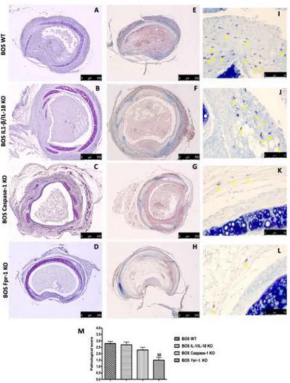 Figure 9. Histopathology evaluation and mast cell density in IL-1β/IL-18 KO, Casp-1 KO, and Fpr- Fpr-1 KO in mice 