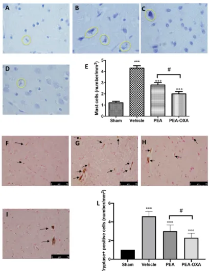 Figure 2. Efficacy of PEA-OXA on mast cell infiltration and degranulation induced by transient  MCAo