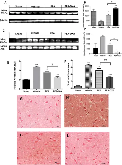 Figure 6. Efficacy of PEA-OXA on IκB-α degradation, NF-κB translocation, and TGF- β expression 