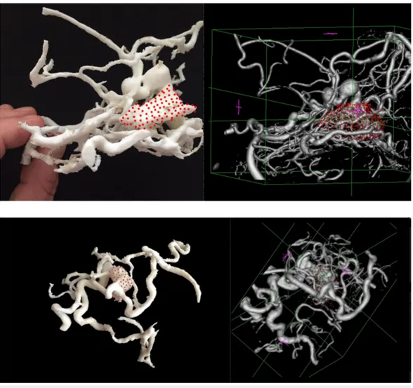 FIGURE 3: 3D-printed arteriovenous malformation prototypes and the corresponding imaging.