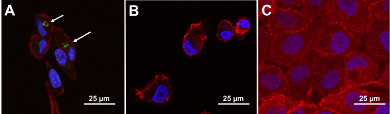 Figure 3. Immunofluorescence analysis of phages towards breast cancer cells in vitro. Phage particles  (~10 10  virions) displaying (A) a breast cancer cell-specific peptide DSFVNAPE or (B) an unrelated 