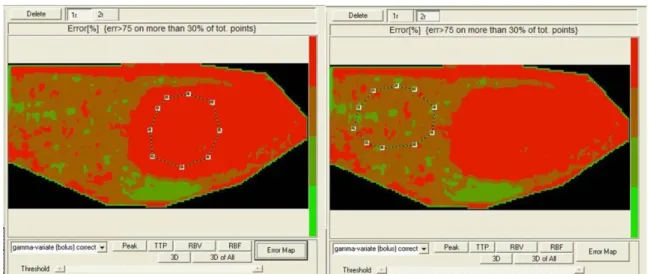 Figure  3.4  Qontrast®  creation  of  Error  Maps  (clinical  case  n°=8).  Error  maps  analysis  of  two  different  ROI;  it  displayed  where  the  pixels  are  depicted  as  a  4  levels  iso-intensity gradient map and where the colour coded bar repre