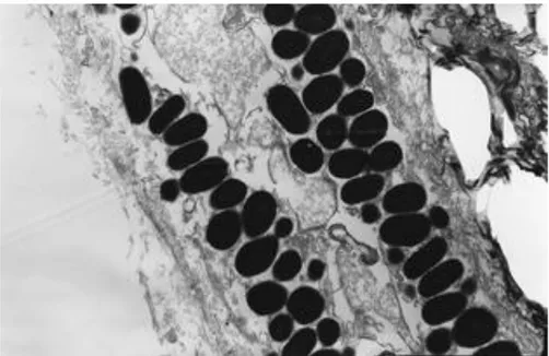 Fig. 13 – Microfotografia che mostra l’ultrastruttura del riflettore e dello strato pigmentato con i tipici granuli di melanina (5000 X) 