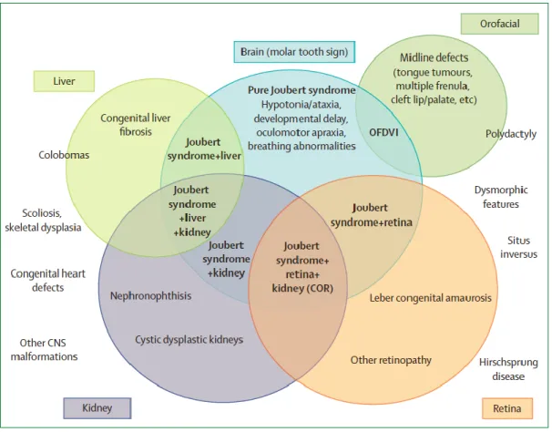 Figura  4:  Spettro  di  organi  coinvolti  nella  sindrome  di  Joubert  e  classificazione  dei  sottogruppi  clinici  (in 