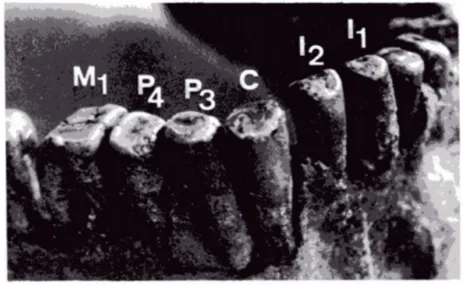 Fig. 9: usura macroscopica dei denti del Neanderthal 