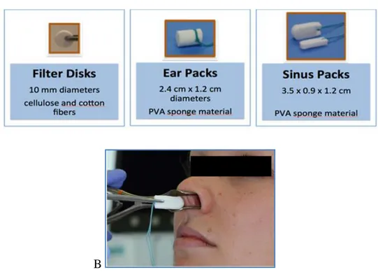 Figure 1. Methodology and results of IgE determination in nasal secretions. A,  The 