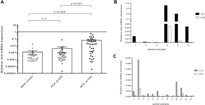 Figure 1: Relative livin mRNA expression levels by quantitative real time RT-PCR analysis