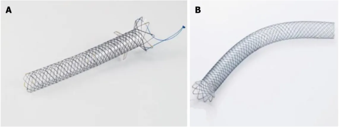 Figure 5  The BPE stent (A), Hanaro MI Tech, and the Giobor Niti-S stent (B), Taewoong Medical.