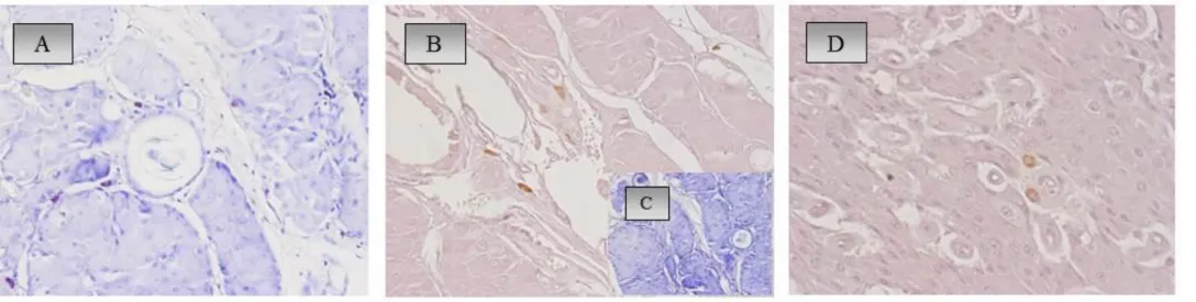 Figura 3: A) Rari mastociti nell’adenoma delle ghiandole epatoidi, BT (10x); B,C) Pochi mastociti peritumorali nel carcimoma ben  