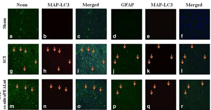 Fig. 4 Co-localization of NeuN/LC3 and GFAP/LC3 after SCI. Results are shown for (a –f) Sham group, (g–l) mice with SCI, and (m–r) mice with SCI treated with co-ultraPEALut