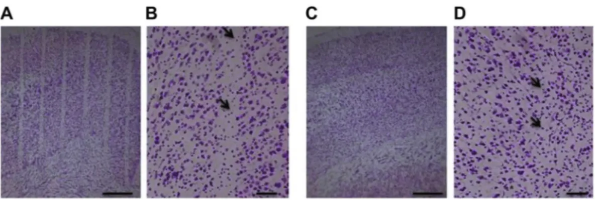 Figure 2.  Nissl staining of cerebral cortex of rats at 3 months after irradiation. Parallel cortical transections 