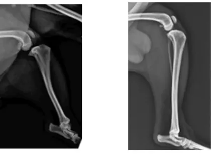 Fig. 14.1: proiezione ML ginocchio sinistro sano (sinistra); proiezione ML ginocchio destro patologico (destra)