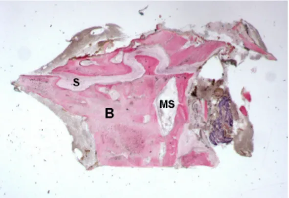 Figure 3. Control. Mature bone (B) with small marrow spaces (MS) was observed. The gap of  the palatal suture (S) appeared characterized by inter-digitations