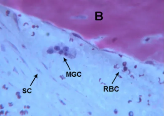 Figure 6. Control. Multi-nucleated giant cells (MGC) near the marginal bone, spindle cells  (SC) and red blood cells were observed (RBC)