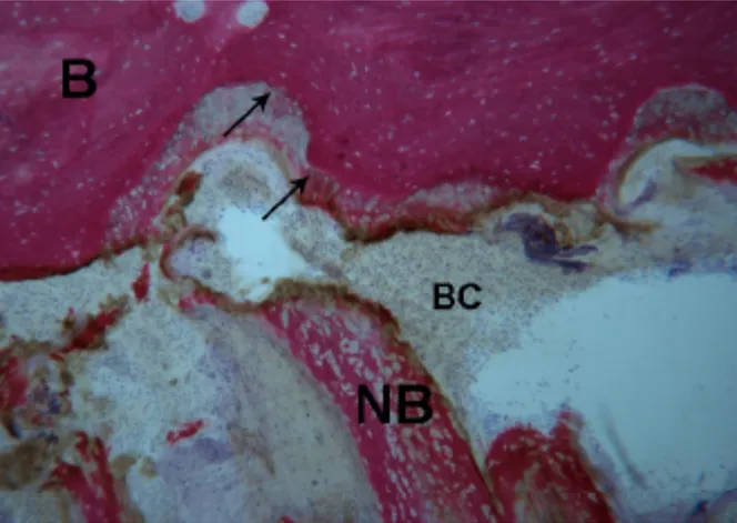 Figure 8. Test 7 days. The bone margins of the suture were characterized by inter-digitations  (black arrows), where the newly-formed osteoid matrix undergoing mineralization directly  was also observed