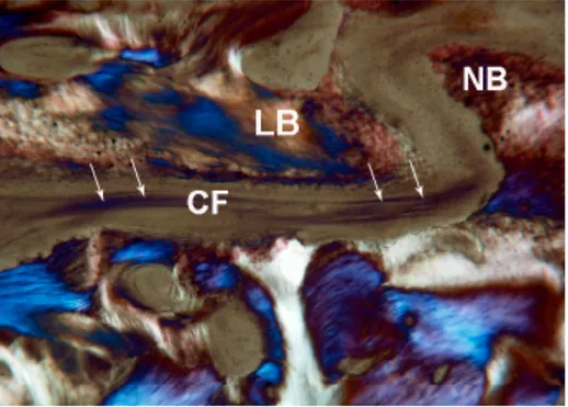 Figure 13. Control. Under polarized light, parallel lamellar bone (LB) and newly-formed  bone (NB) without parallel collagen fiber orientation were observed
