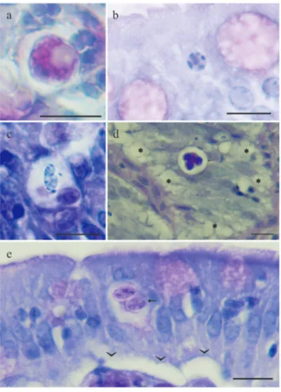 Fig. 3. Histological sections of European sea bass digestive tract infected with Eimeria  dicentrarchi