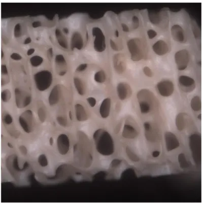 Fig. 10 Gruppo B: cavità comunicanti morfologicamente ben conservate di forma ovoidale e  sferica delimitate da una densa trabecolazione (40x)