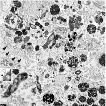 Figure 7.  Transmission electron microscopy (TEM) of Mycobacterium sp. (white arrows) free in the 