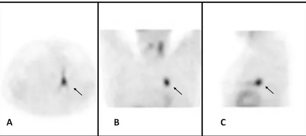 Figure  2.Single  photon  emission  tomography  of  chest  (magnification  1.4;  matrix  256x256;  acquisition  modalities,  step  and 