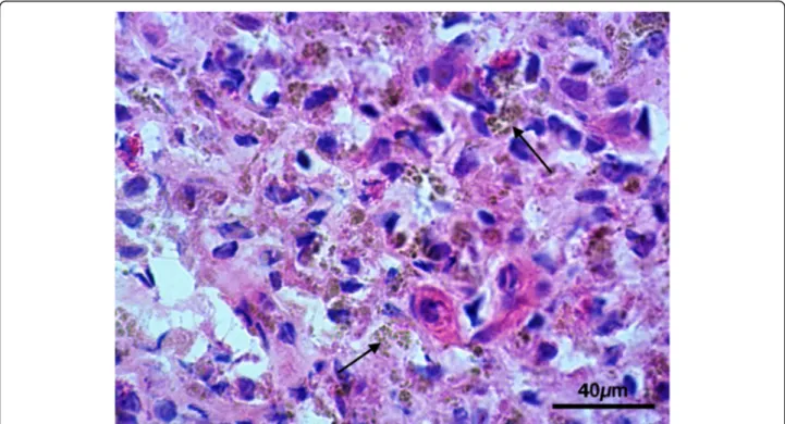 Fig. 2 Lymph nodes: Lymph node tissue sections shown a macrophage infiltrate containing a granular brownish pigment (Arrows) (H&amp;E)