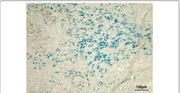 Fig. 4 Lymph nodes: Evidence of dark green granules in macrophages. (Lillie)