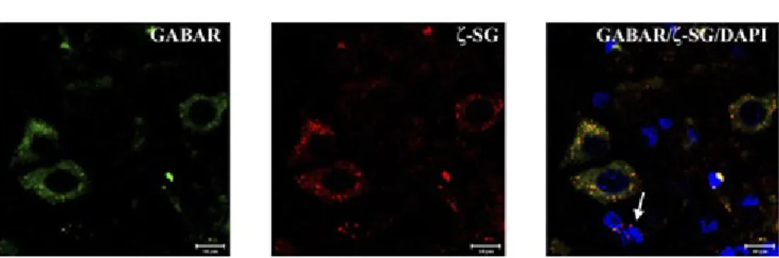 Fig. 2 – High magnification of pyramidal neurons of motor cortex area. ζ-SG (red channel) is expressed by  a “spot-like” staining pattern in cellular soma