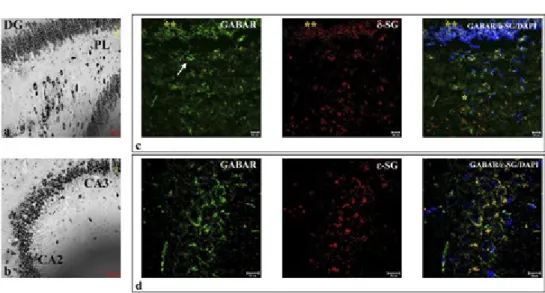 Fig. 4 – Nissl staining shows dentate gyrus, Purkinje cell layer (PL) (a) and Cornu Ammonis (CA)2, CA3 (b)  at high magnification
