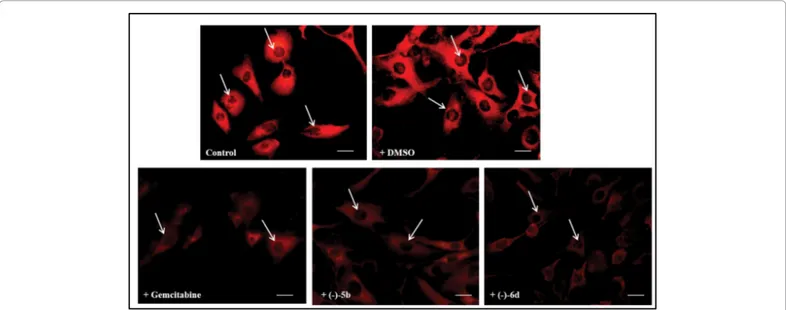 Figure 2: Fluorescent microscopic analysis of TG2 expression in FTC-133 human thyroid cancer cell lines untreated (Control) or DMSO without drugs 