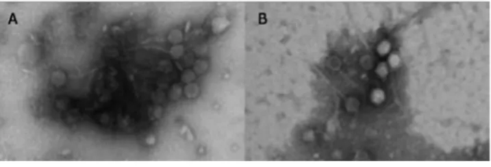 Figure  1.  Tailed  bacteriophages  found  in  mitomycin-C  induced supernatants of strain 6081-97 (A) and 5416-97 (B)