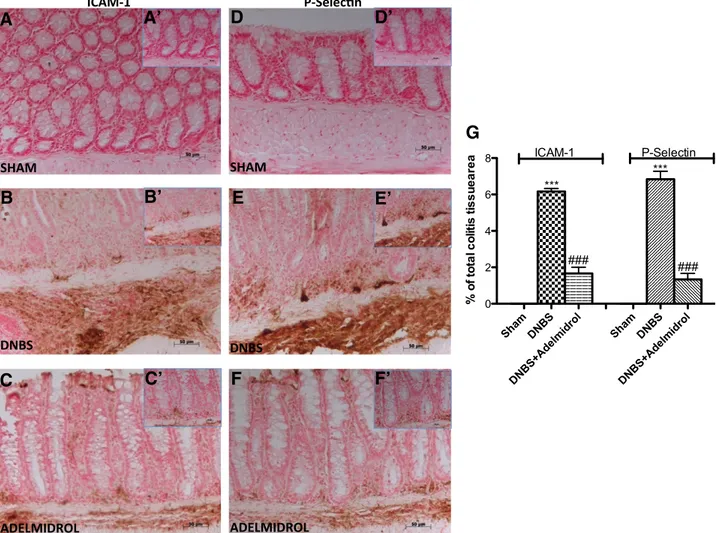 Fig. 5. Adelmidrol treatment reduces ICAM-1 and P-selectin expression in DNBS-induced ICAM-1