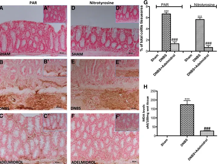 Fig. 6. Effects of adelmidrol treatment on nitrotyrosine and PAR formation and lipid peroxidation in DNBS-induced colitis