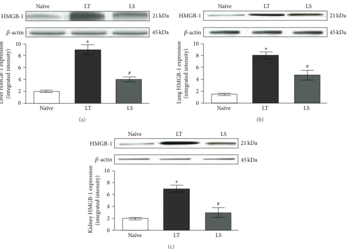 Figure 3: Representative western blot analysis of HMGB-1 protein in liver (a), lung (b), and kidney (c) from animals subjected to CLP followed by LT or LS procedures and na¨ıve animals