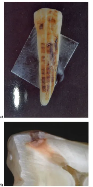 Figure 3: Photo of an incisive tooth irradiated on all surface (the black colour is due to the proton beam irradiation) (a), a particular of the  enamel-dentine interface (b), a cross-sectioned dentine (c), and cross-sectioned decayed enamel and dentine in