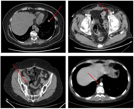 Figure 4. Some instances of TARGET lesions (identified by red arrows) manually selected by 