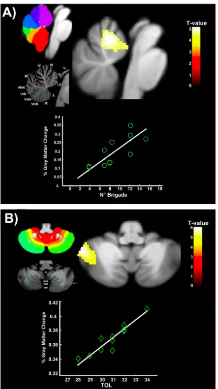 Fig 1. Voxel-based differences between Chefs and non-expert individuals. Statistical maps displaying