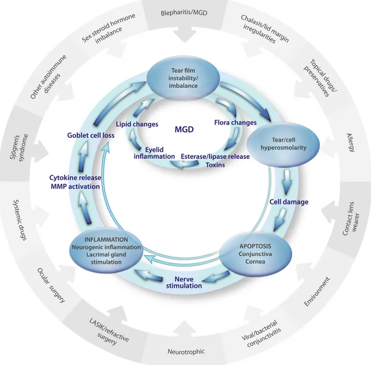 Fig. 1. Vicious circle of dry eye disease. MGD = Meibomian gland dysfunction; LASIK = Laser-assisted in situ keratomileusis; MMP = Matrix metalloproteinase