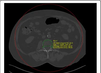 Fig. 1 After automatic placement by the post-processing software (Examine, Siemens), the VOI was manually defined by the user in order to achieve the best delineation of the trabecular bone and exclusion of any cortical bone