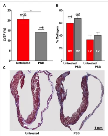 FIGURE 6 | (A) Left ventricular ejection fraction is worsened by PSB115 treatment in PKP2cKO mice 35 days after tamoxifen injection