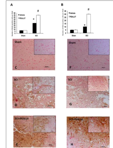 FIGURE 2 | Effect of co-ultraPEALut on cell proliferation in spinal cord of SCI mice. (A) BrdU (70 mg/kg, i.p.) was given 2 h before sacrifice to examine the effects of 72 h co-ultraPEALut administration